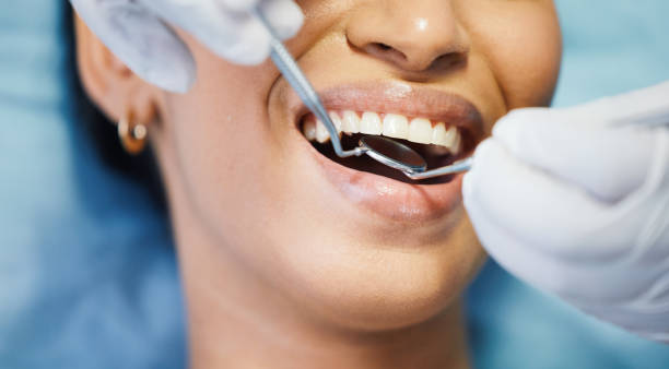 Best Emergency Dentist for Special Needs Patients in Flossmoor, IL