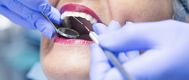Best Emergency Dental Care for Abscessed Tooth in Flossmoor, IL