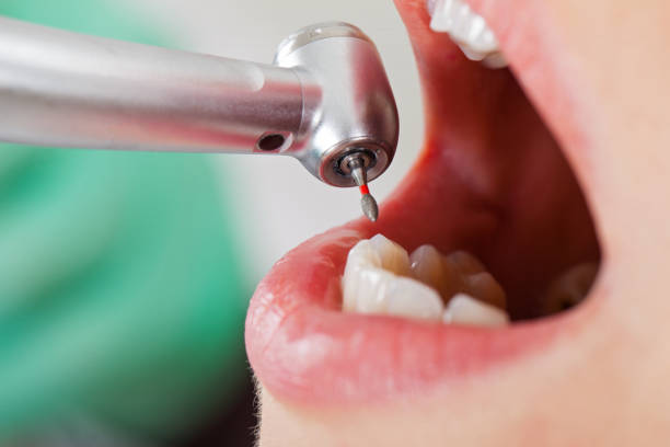 Best Mobile Emergency Dentist in Flossmoor, IL